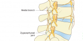 Nessa imagem podemos ver o Medial Branch ( Ramo medial) do ramo dorsal do nervo Espinhal. A lesão térmica é nesse nervo. É aí que é colocado a agulha.