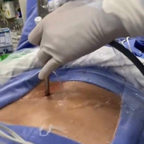 Cirurgia para Hérnia de Disco